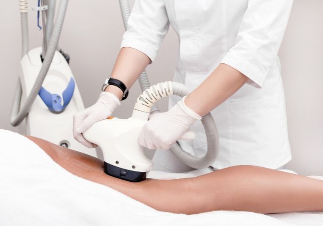 VelaShape en Cure Estética – Remodela tu cuerpo sin cirugía estética