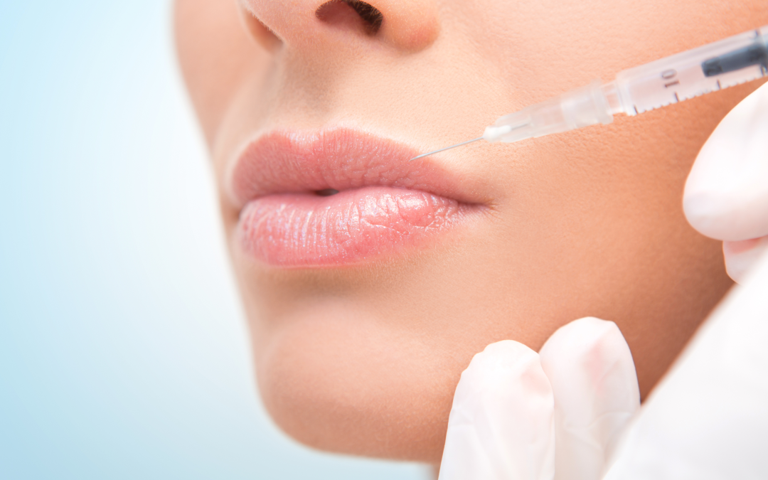 Ácido hialurónico en labios con Juvéderm | Cure Clínica Estética