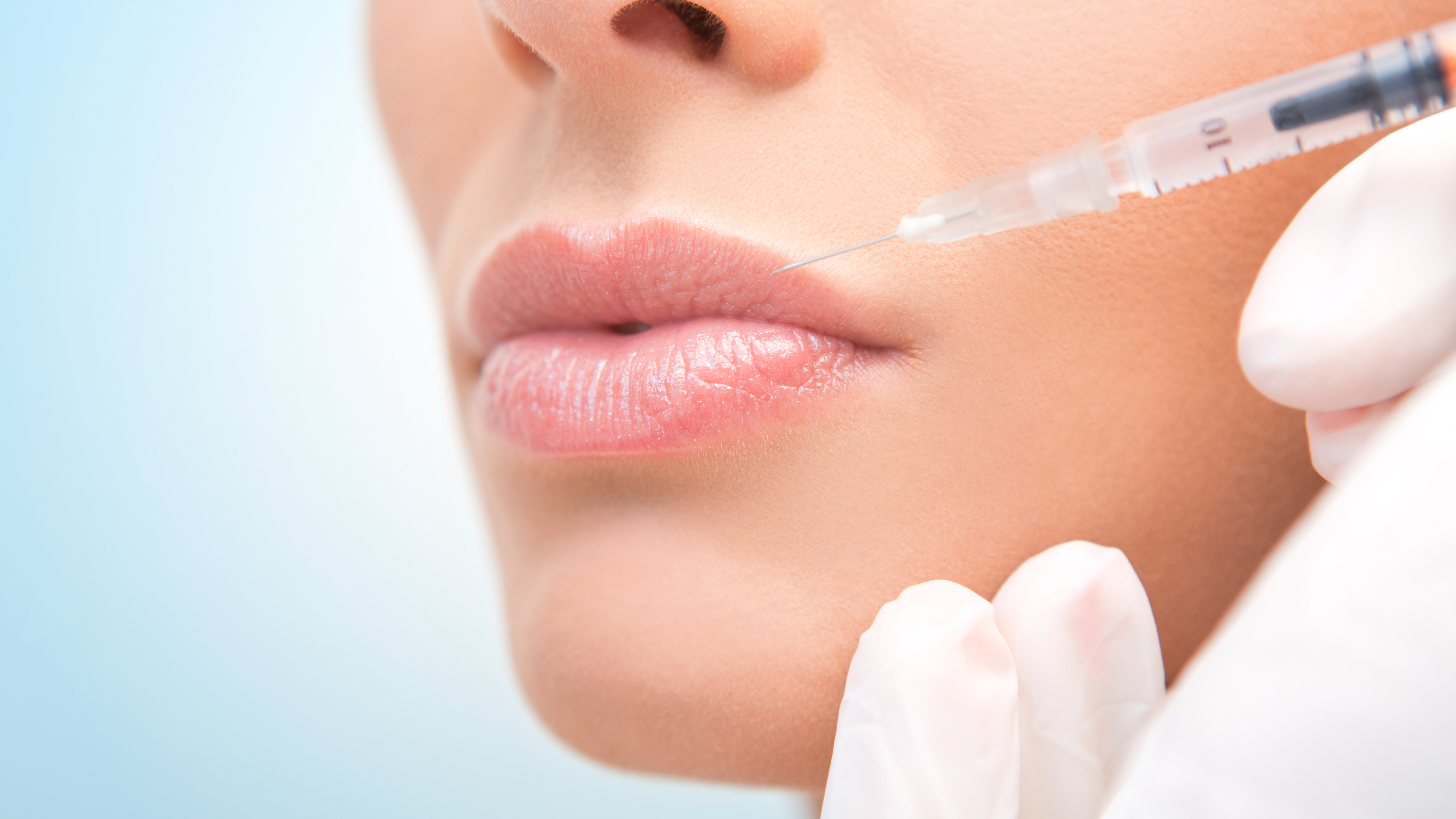 Tratamiento con ácido hialurónico en labios en Cure Clínica Estética