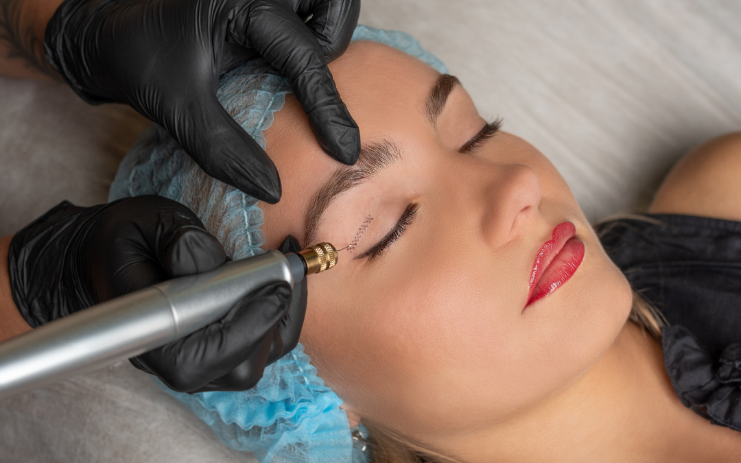 Plasma Pen: el tratamiento que revoluciona la regeneración de la piel